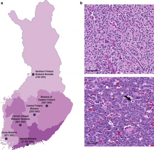 Finnish-biobank-network-and-histological-images-of-typical-carcinoid-TC-and-atypical.png